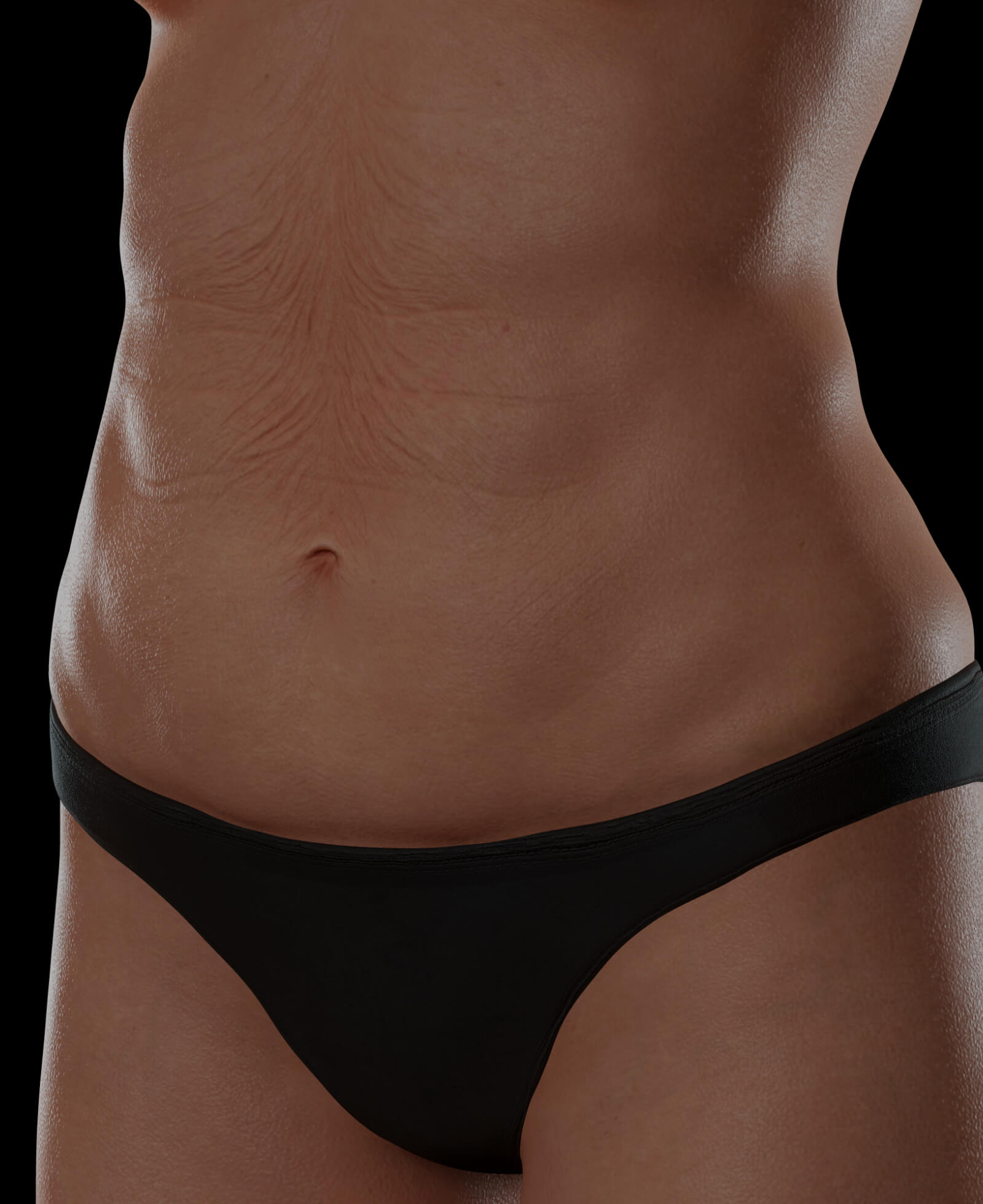 Female patient at Clinique Chloé with body skin laxity looking for body skin tightening