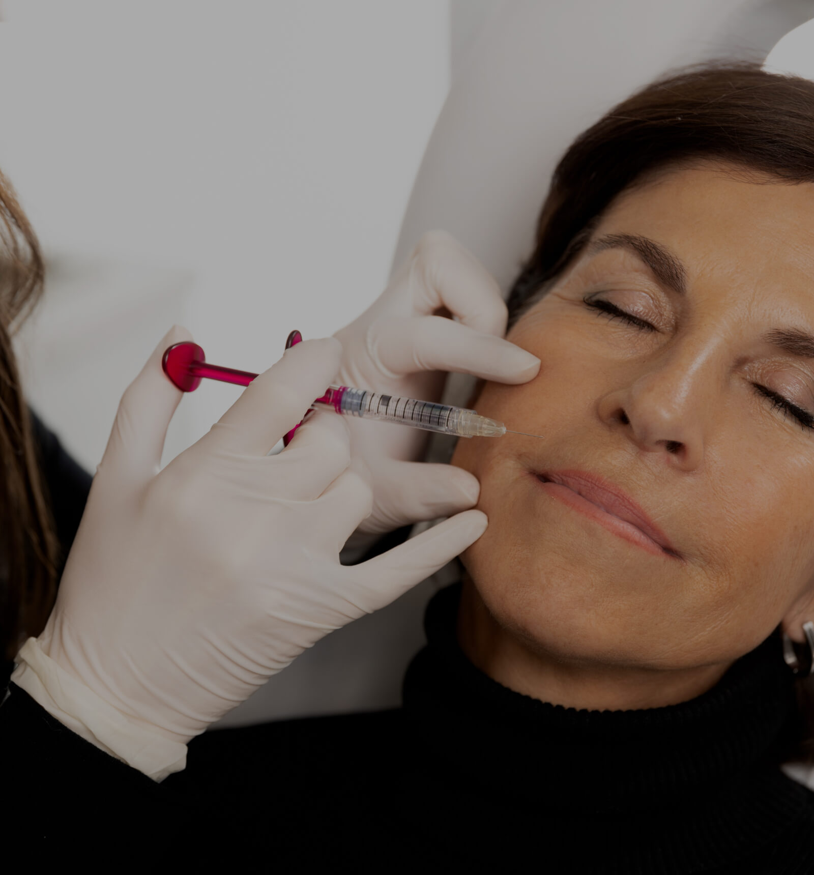 Un médecin de la Clinique Chloé effectuant un traitement de mésothérapie pour atténuer les sillons nasogéniens d'une patiente