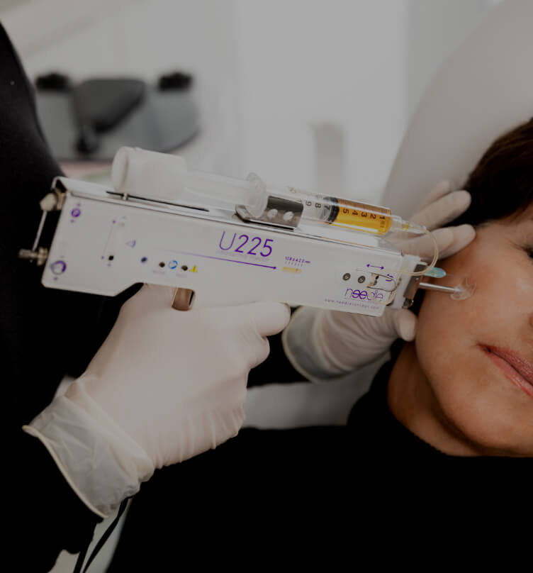 Une infirmière de la Clinique Chloé pratiquant un traitement de plasma riche en plaquettes sur le visage d'une patiente
