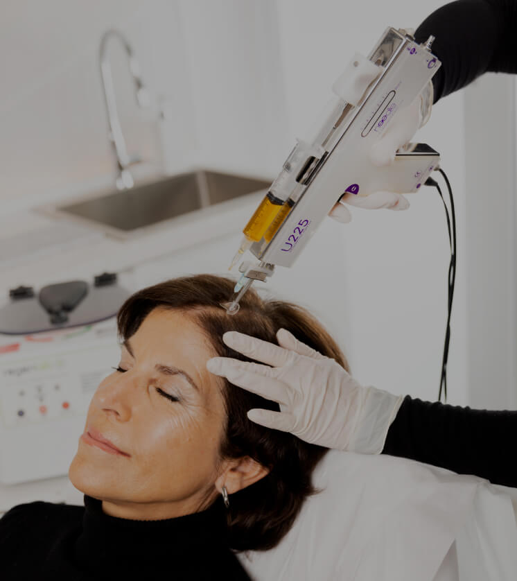 Une infirmière de la Clinique Chloé pratiquant un traitement de plasma riche en plaquettes sur le cuir chevelu d'une patiente