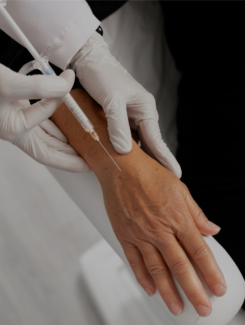 Un médecin de la Clinique Chloé pratiquant des injections de Radiesse dans les mains d'une patiente