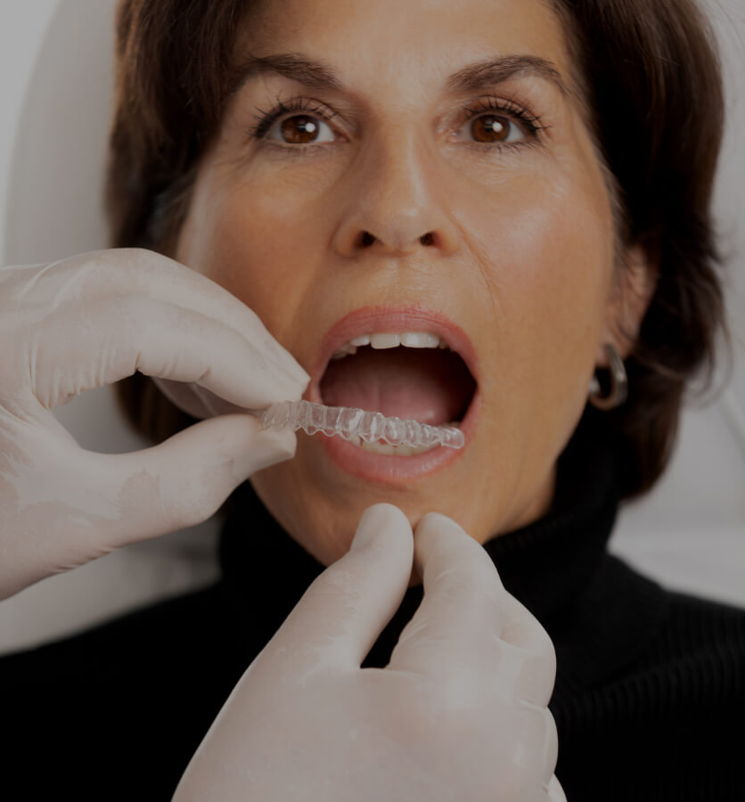 Le dentiste de la Clinique Chloé installant un aligneur transparent Invisalign dans la bouche d'une patiente