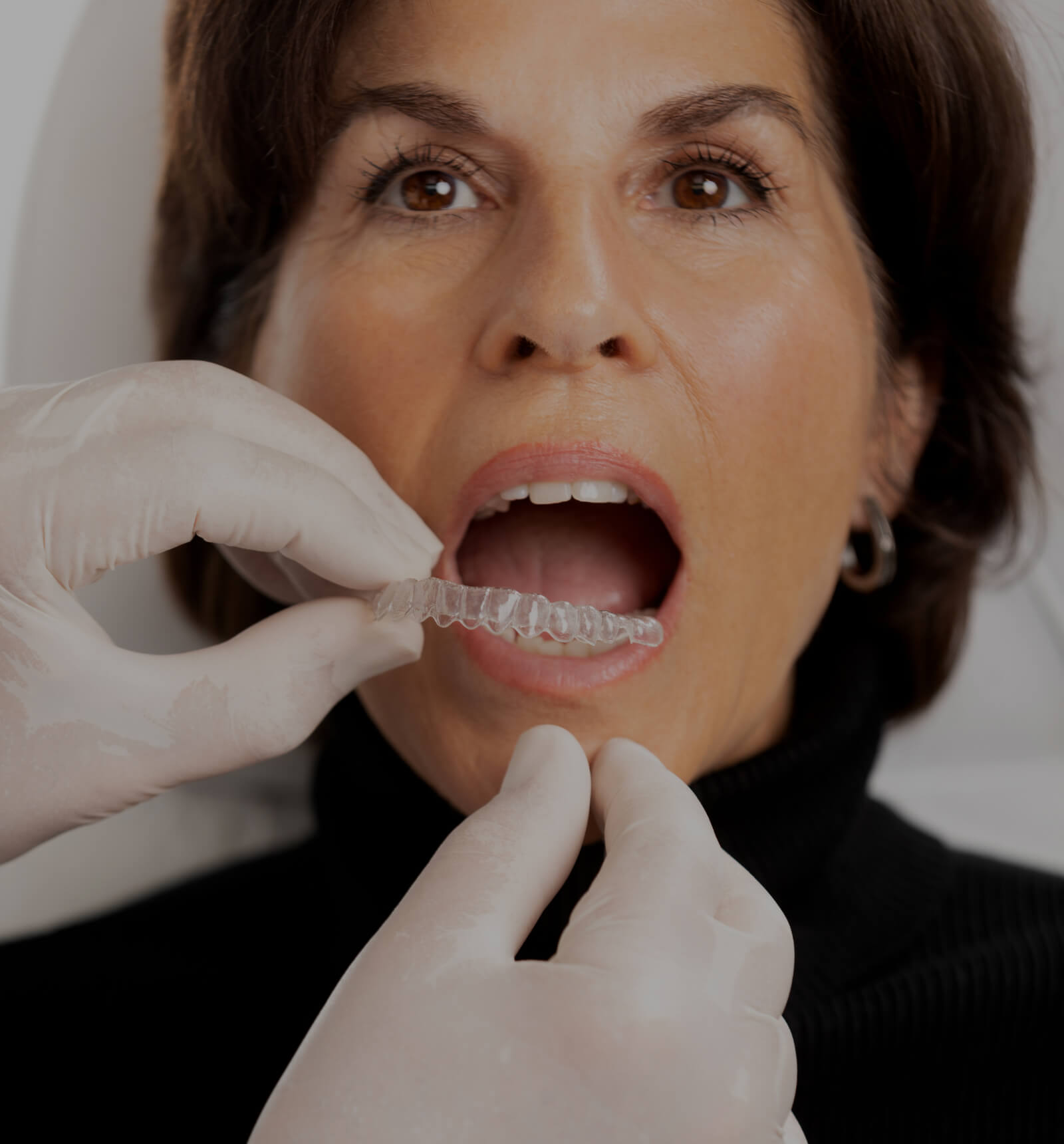 The dentist at Clinique Chloé installing an Invisalign clear aligner in a female patient's mouth