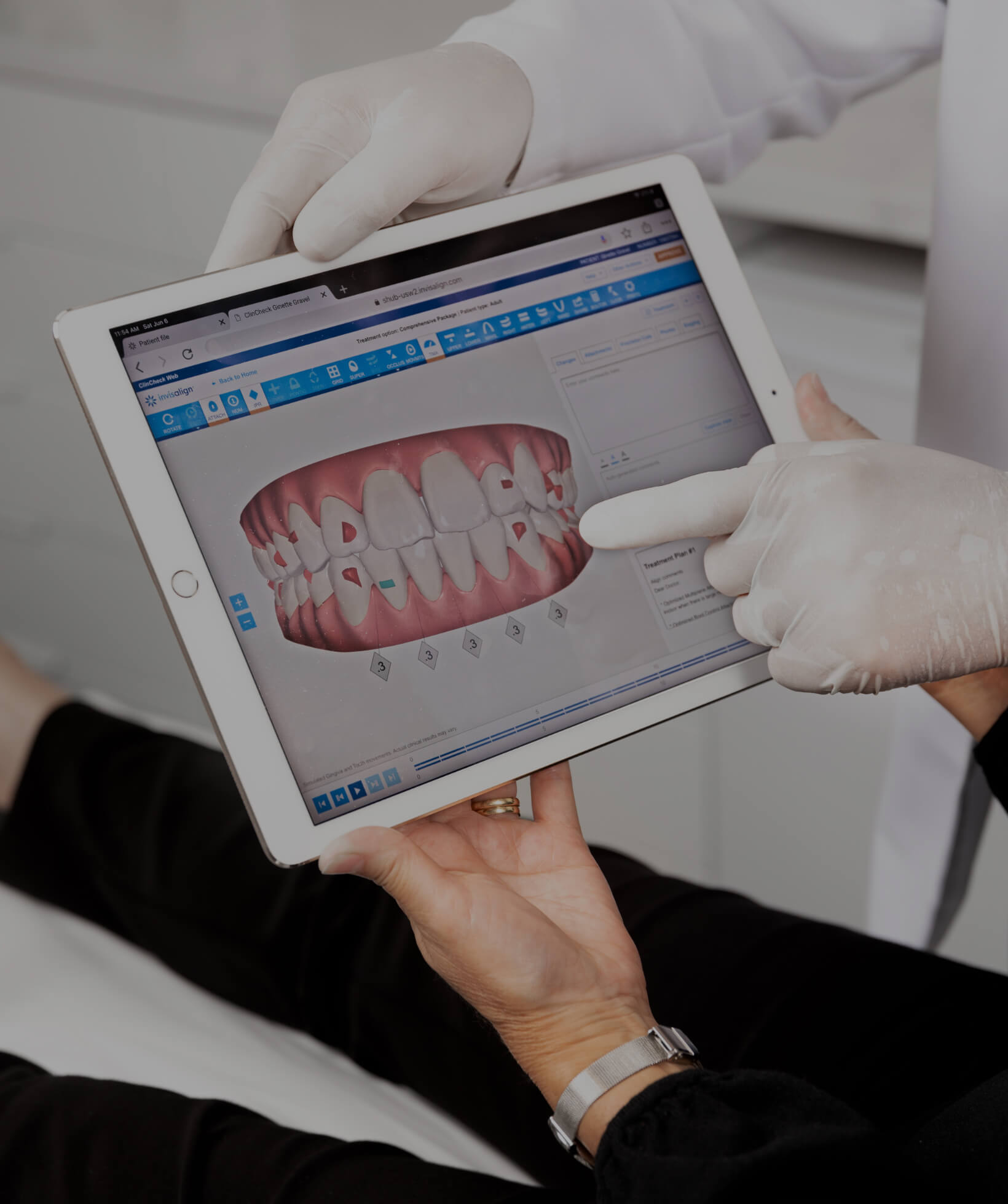 The dentist at Clinique Chloé showing an Invisalign simulation to his patient on an iPad