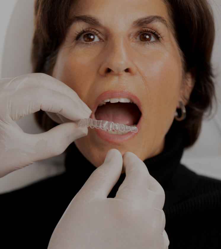 The dentist at Clinique Chloé installing an Invisalign clear aligner in a female patient's mouth