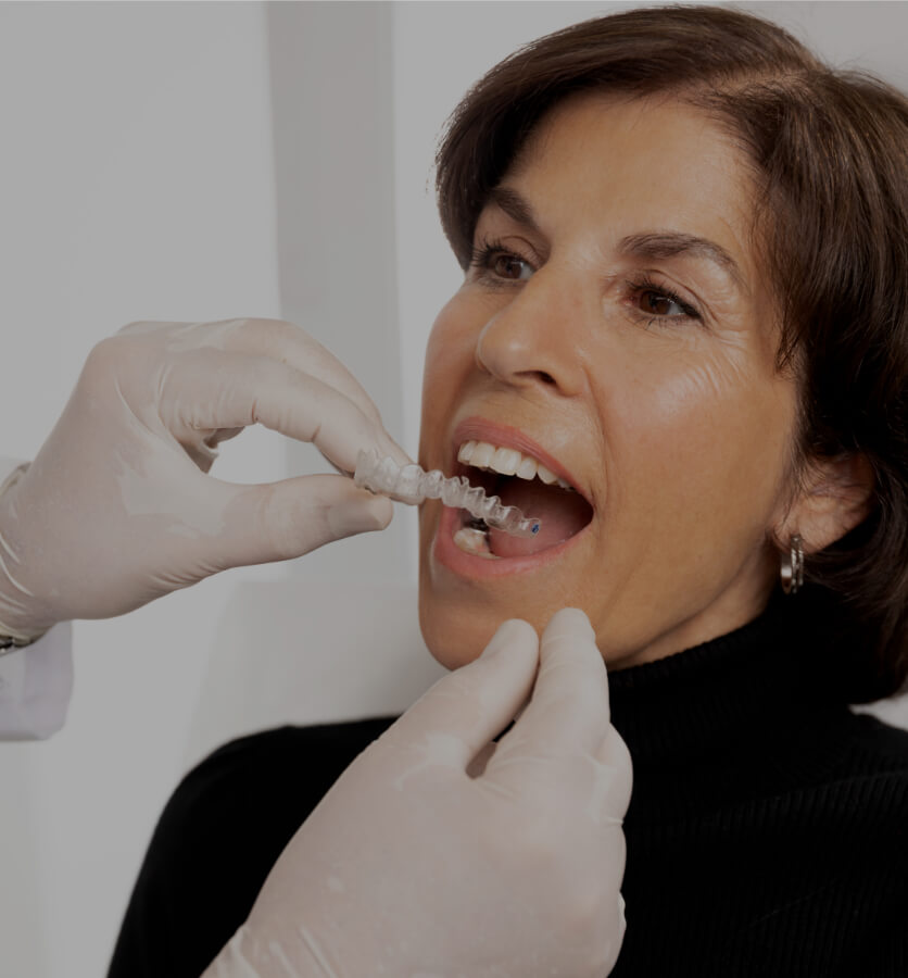 The dentist at Clinique Chloé installing the dental gutters filled with teeth whitening product in a female patient's mouth