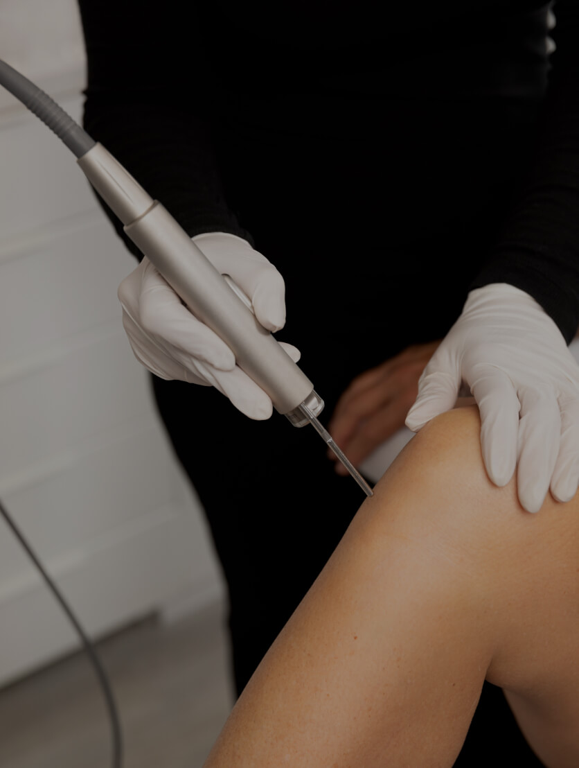 Une technicienne de la Clinique Chloé utilisant un laser pour l'épilation permanente des jambes d'une patiente