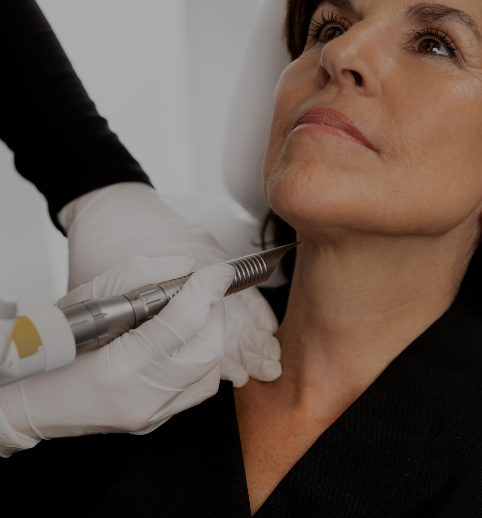 Une technicienne médico-esthétique de la Clinique Chloé traitant le cou d'une patiente avec le laser Fotona 4D