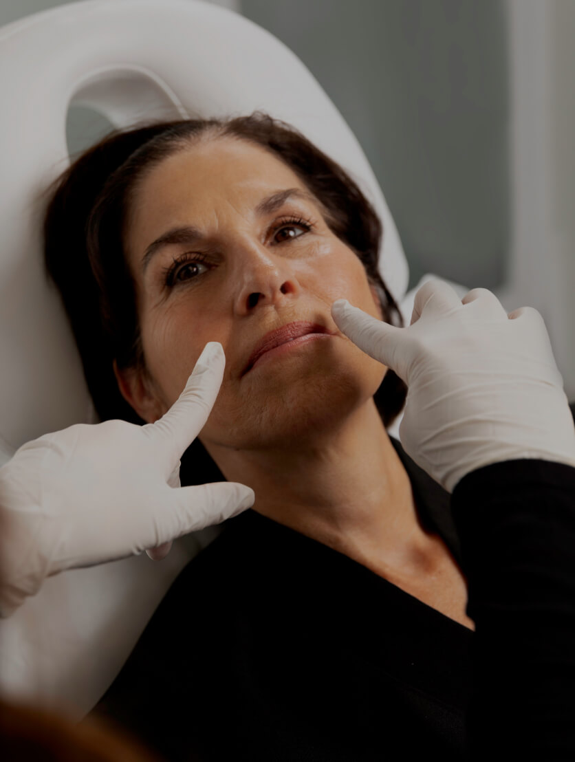 A medico-aesthetic technician from Clinique Chloé demonstrating the nasolabial folds of a female patient
