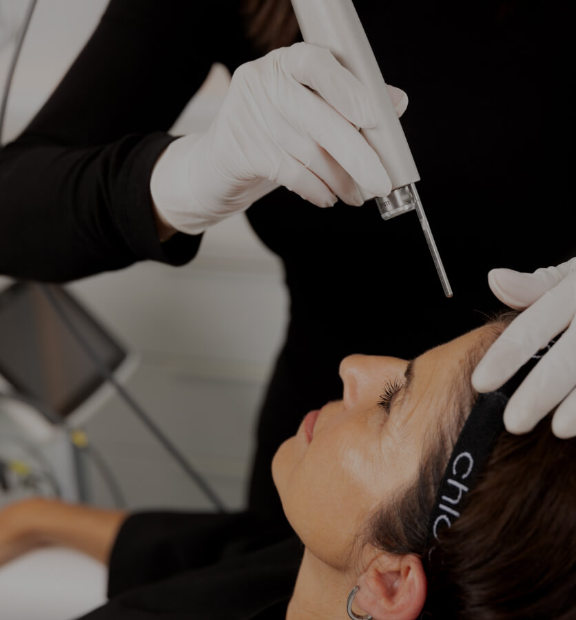A medico-aesthetic technician from Clinique Chloé treating a patient's forehead with the Fotona Acne laser