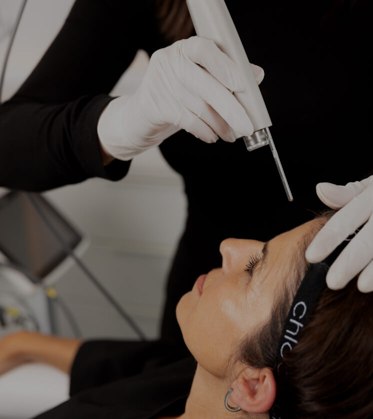 A medico-aesthetic technician from Clinique Chloé treating a patient's forehead with the Fotona Acne laser