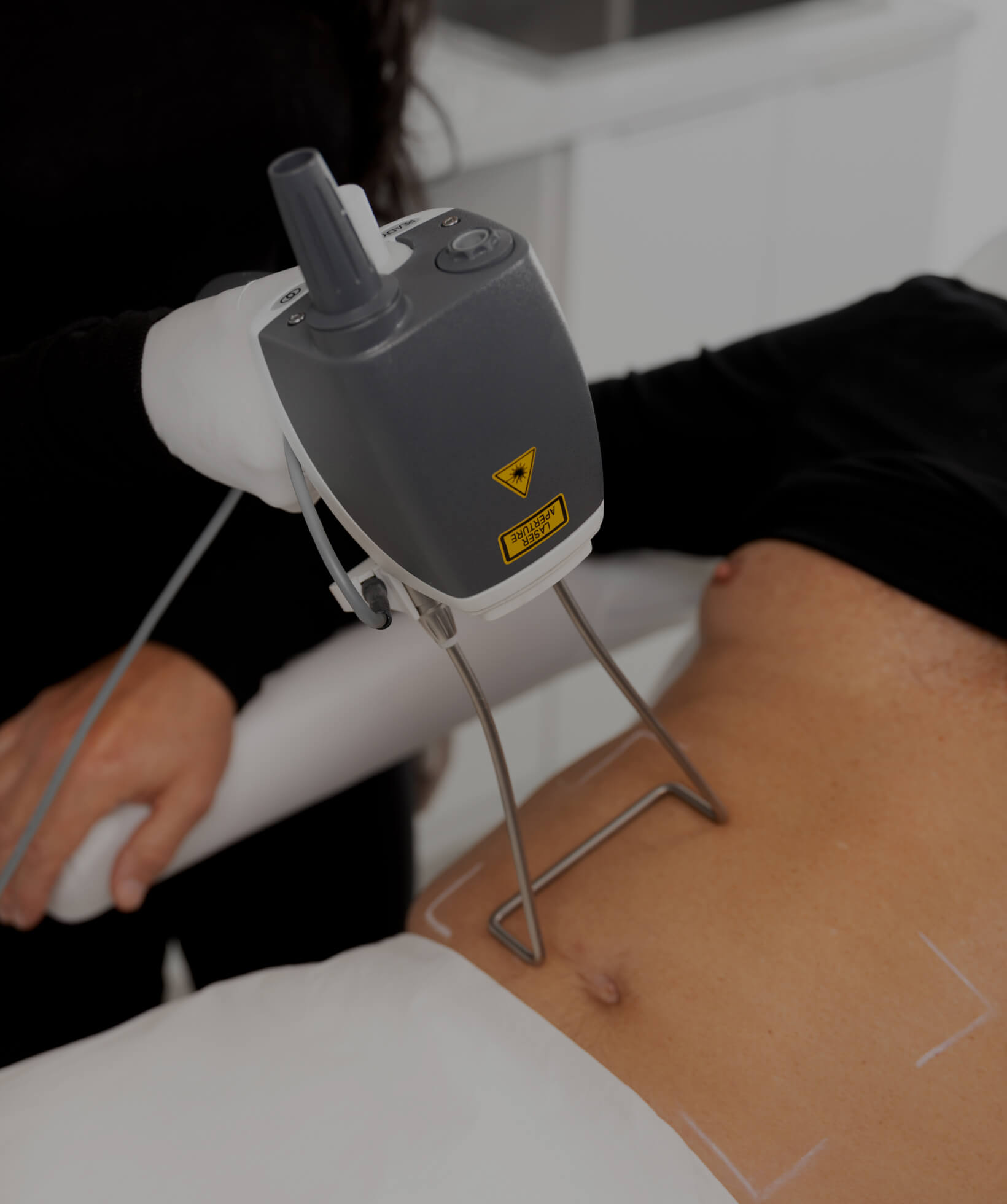 Une technicienne médico-esthétique de la Clinique Chloé traitant l'abdomen d'un patient avec le laser Hot Sculpting
