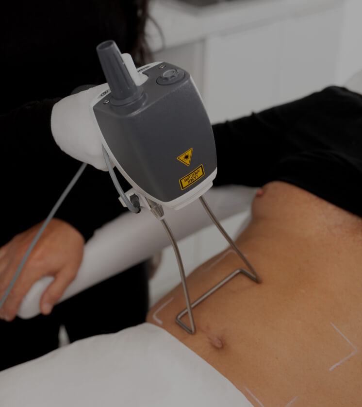 A medico-aesthetic technician from Clinique Chloé treating the abdomen of a patient with the Hot Sculpting laser