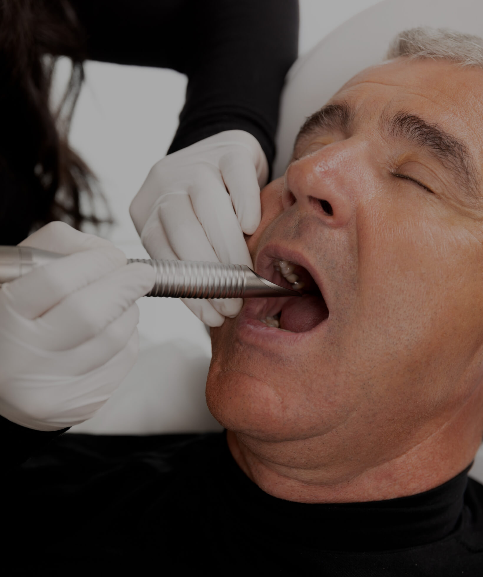 A Clinique Chloé medical aesthetic technician performing a NightLase intraoral laser treatment in a patient's mouth