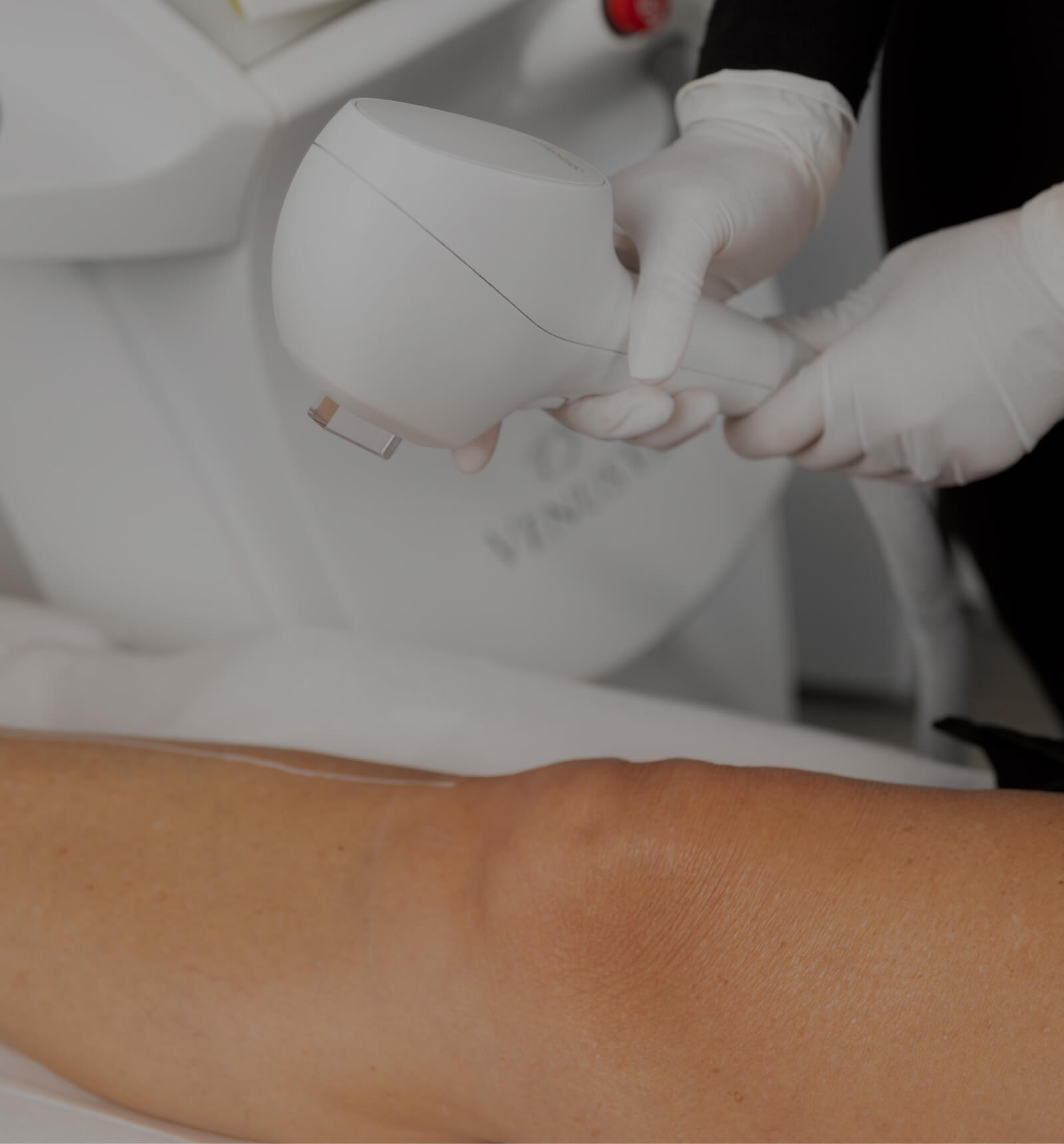 A medical aesthetic technician from Clinique Chloé preparing to perform permanent IPL hair removal on a patient's leg