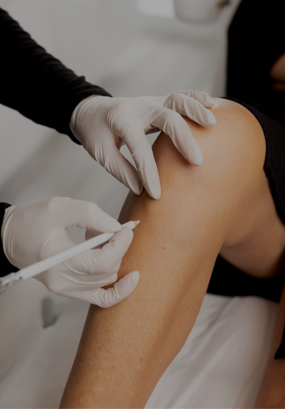 A medico-aesthetic technician from the Chloé Clinic delimiting the areas for laser hair removal on a woman's legs