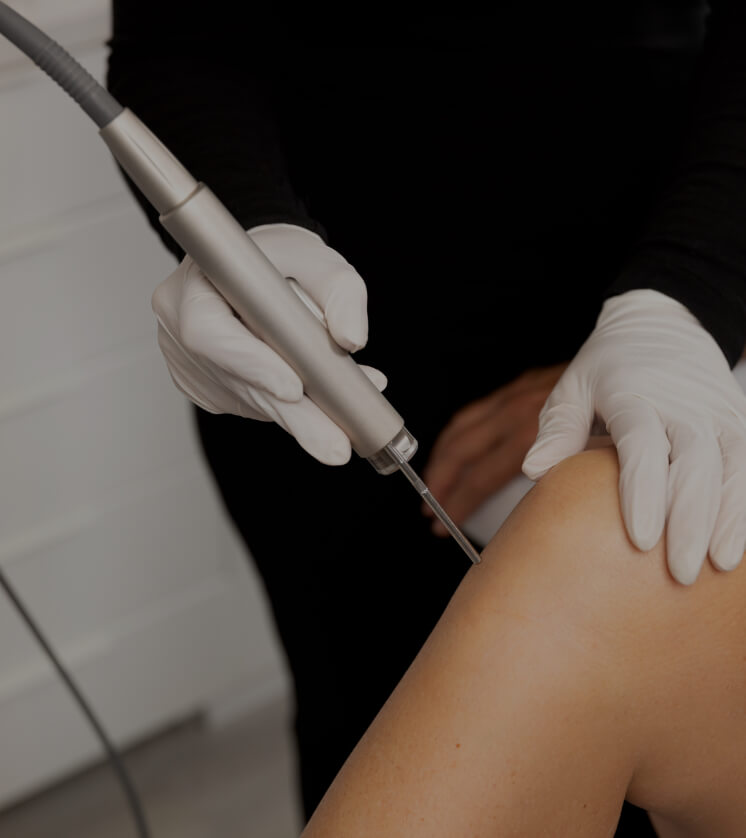 A medical aesthetic technician from Clinique Chloé using a laser for permanent hair removal on a patient's legs