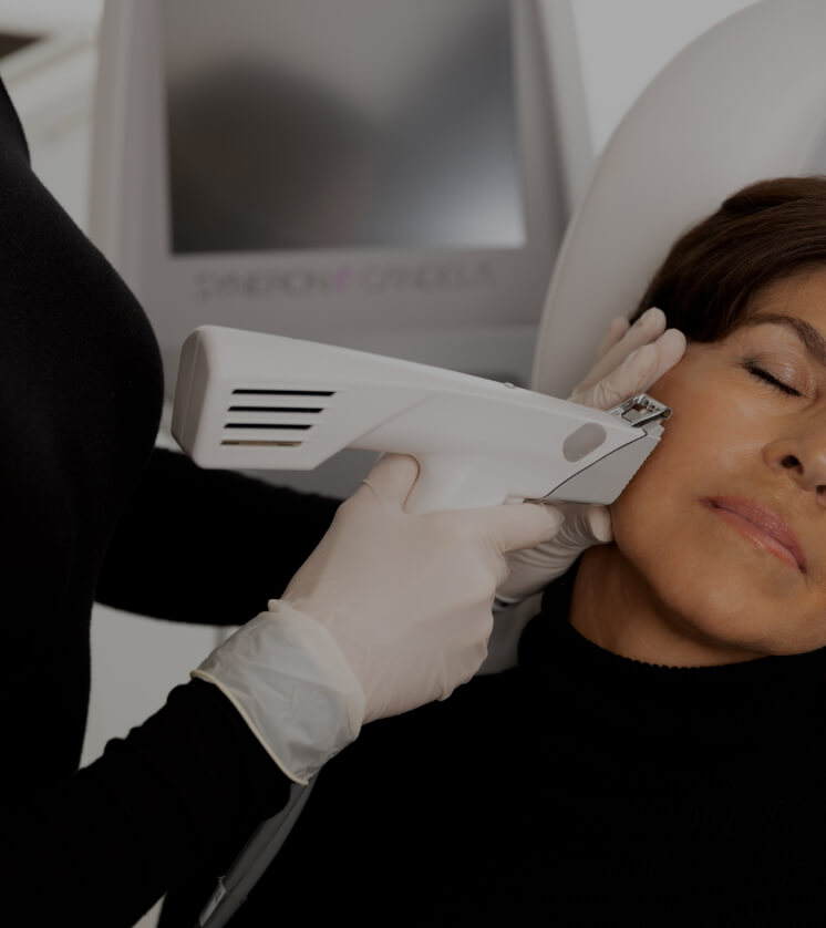 A nurse at Clinique Chloé treating a patient's face with the Profound radiofrequency microneedling device