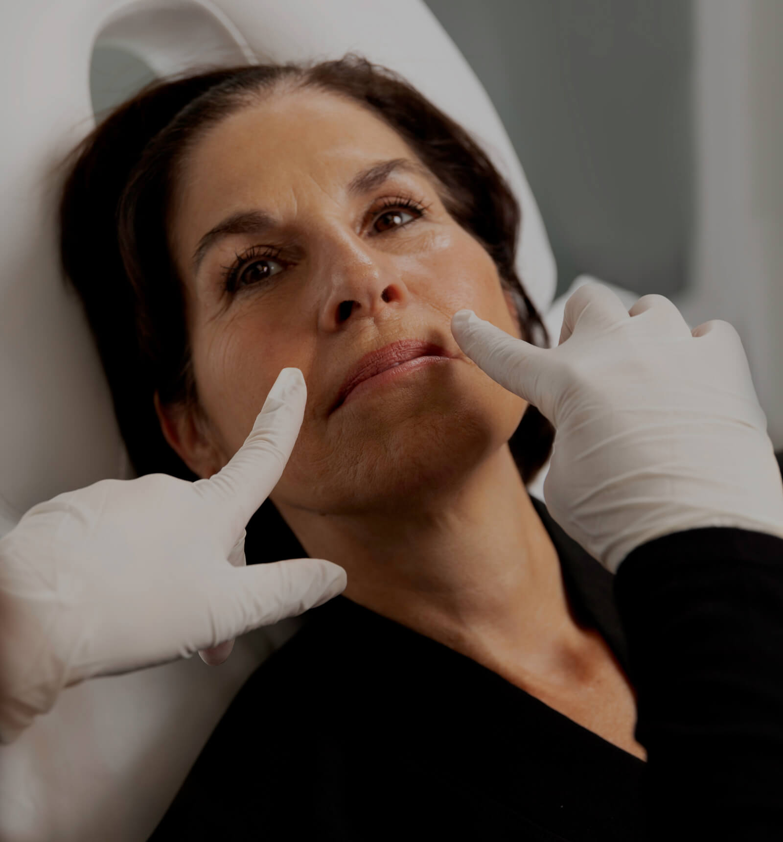 Une technicienne de la Clinique Chloé montrant les rides naso-labiales d'une patiente avec ses deux doigts