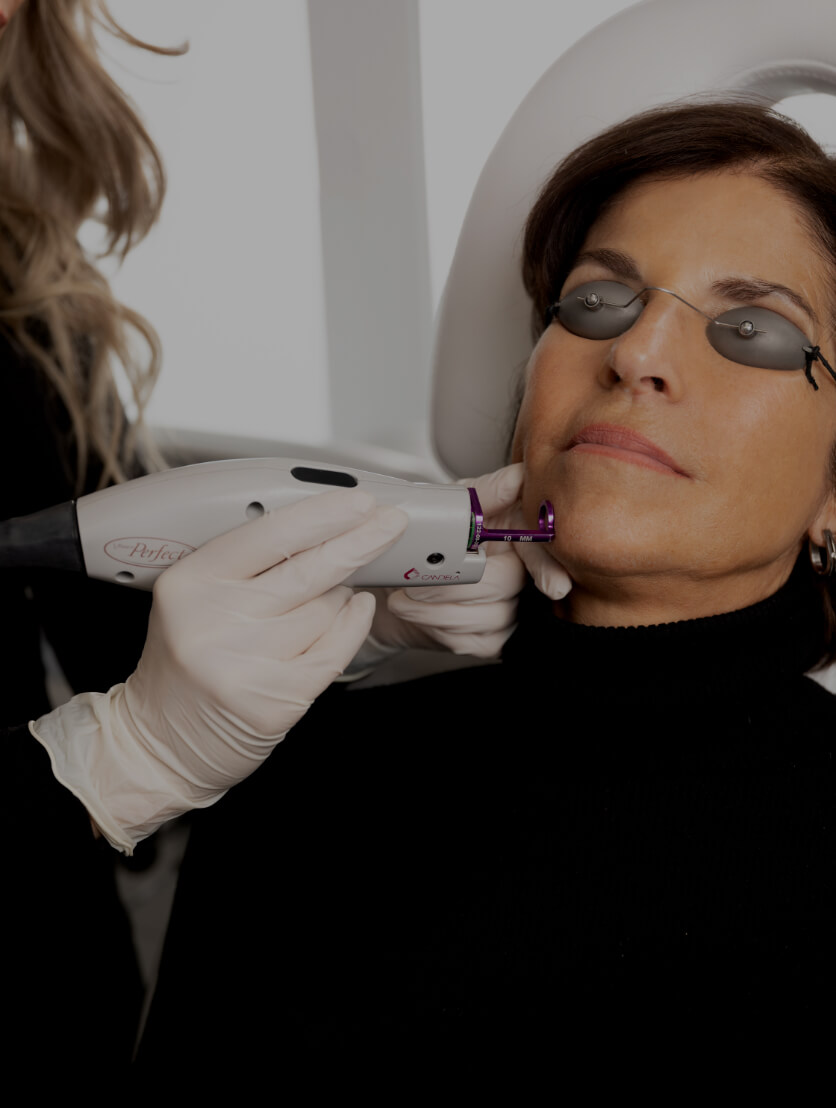 A medical aesthetic technician from Clinique Chloé treating vascular lesions with the Vbeam laser on a patient's face