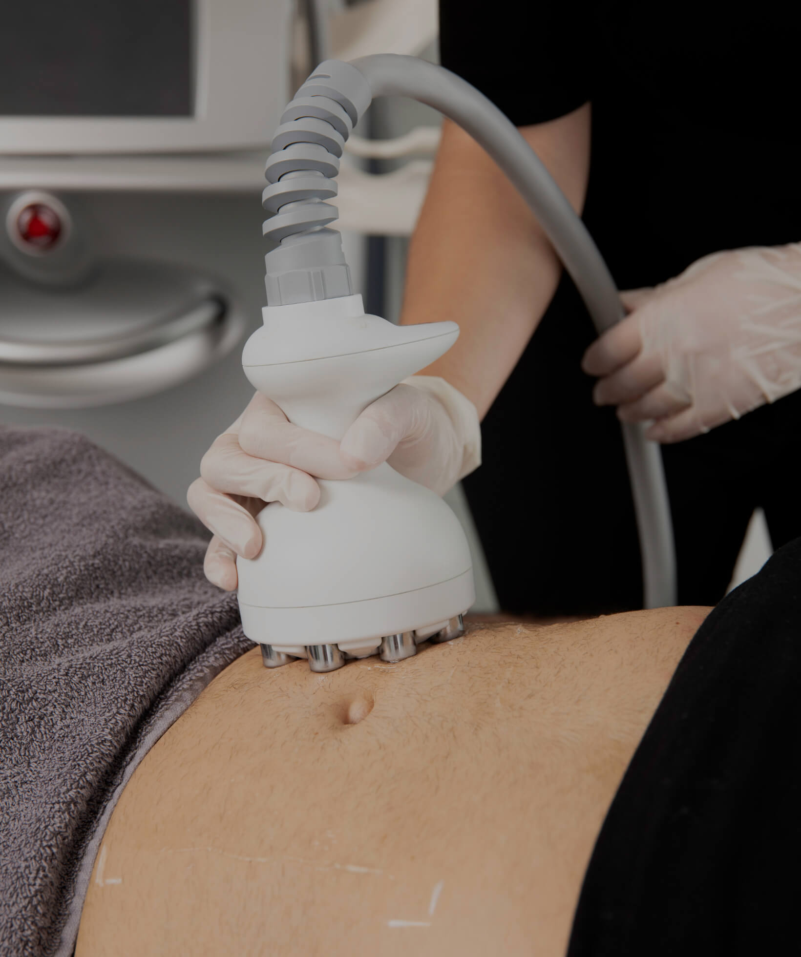 A technician from Clinique Chloé sliding the Venus Legacy radiofrequency handpiece onto a patient's abdomen