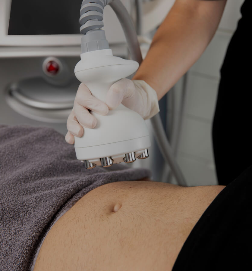 A medical aesthetic technician from Clinique Chloé holding the Venus Legacy handpiece above a patient's abdomen