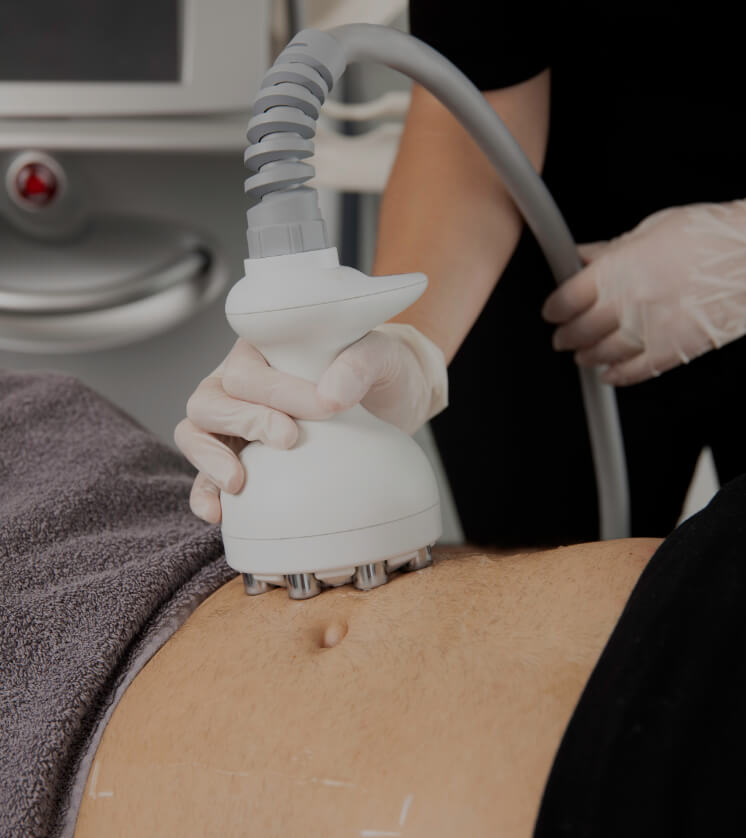 A technician from Clinique Chloé sliding the Venus Legacy radiofrequency handpiece onto a patient's abdomen