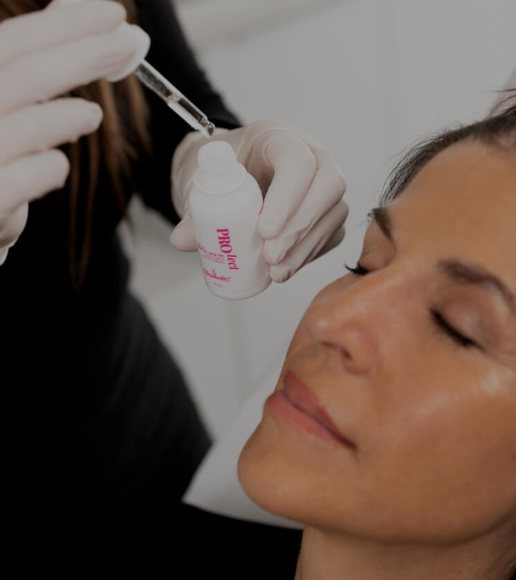 Une technicienne de la Clinique Chloé appliquant un sérum sur le visage d'une patiente après un traitement de microneedling