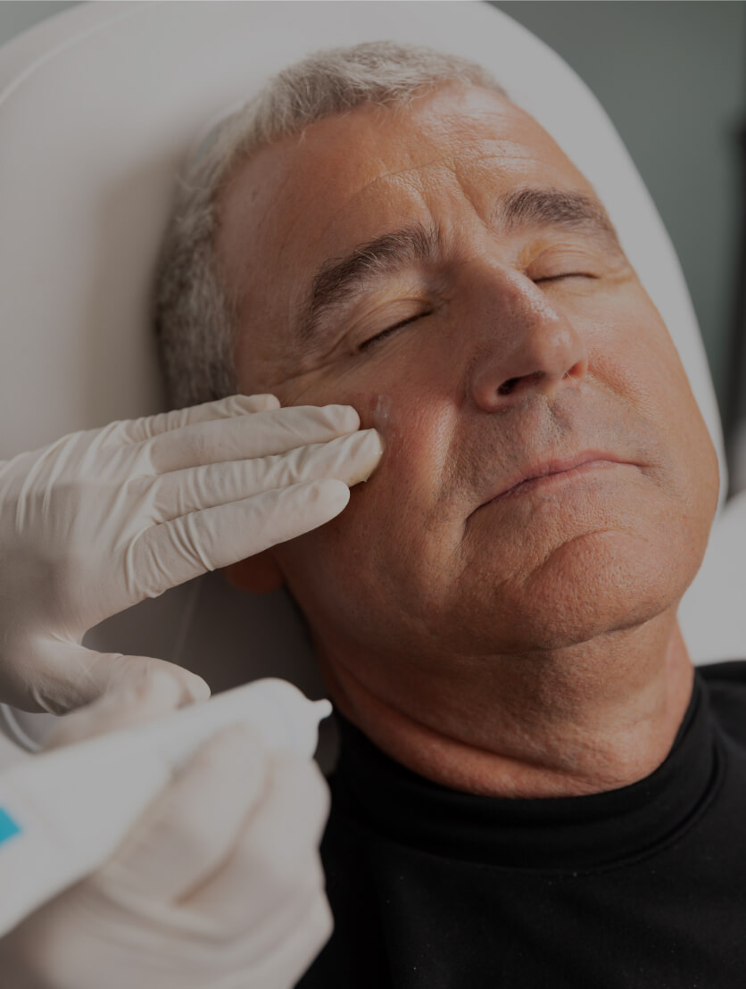 Une technicienne de la Clinique Chloé appliquant de la crème apaisante sur le visage d'un patient après un peeling chimique