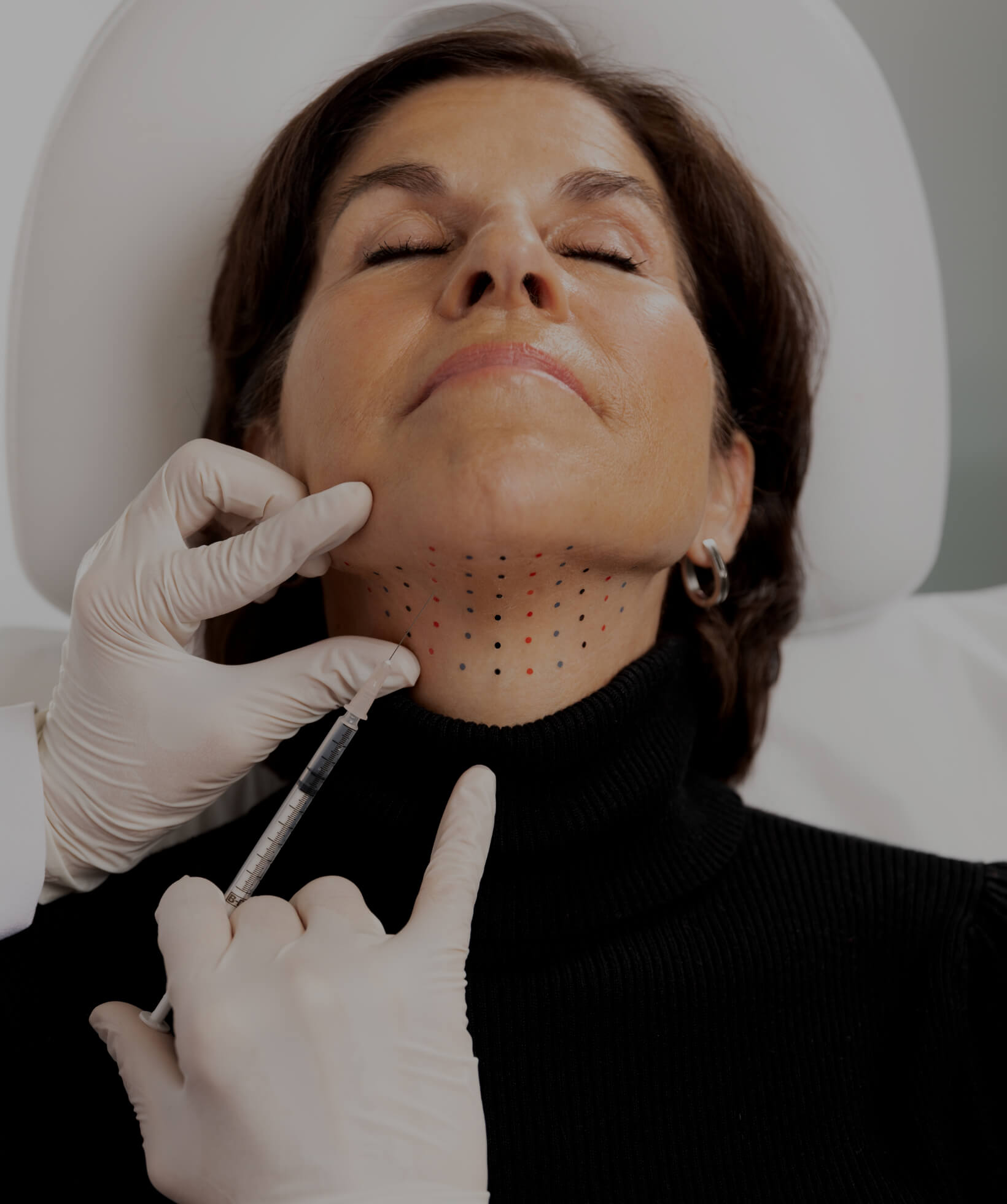 A doctor at Clinique Chloé doing Belkyra injections into a female patient's double chin