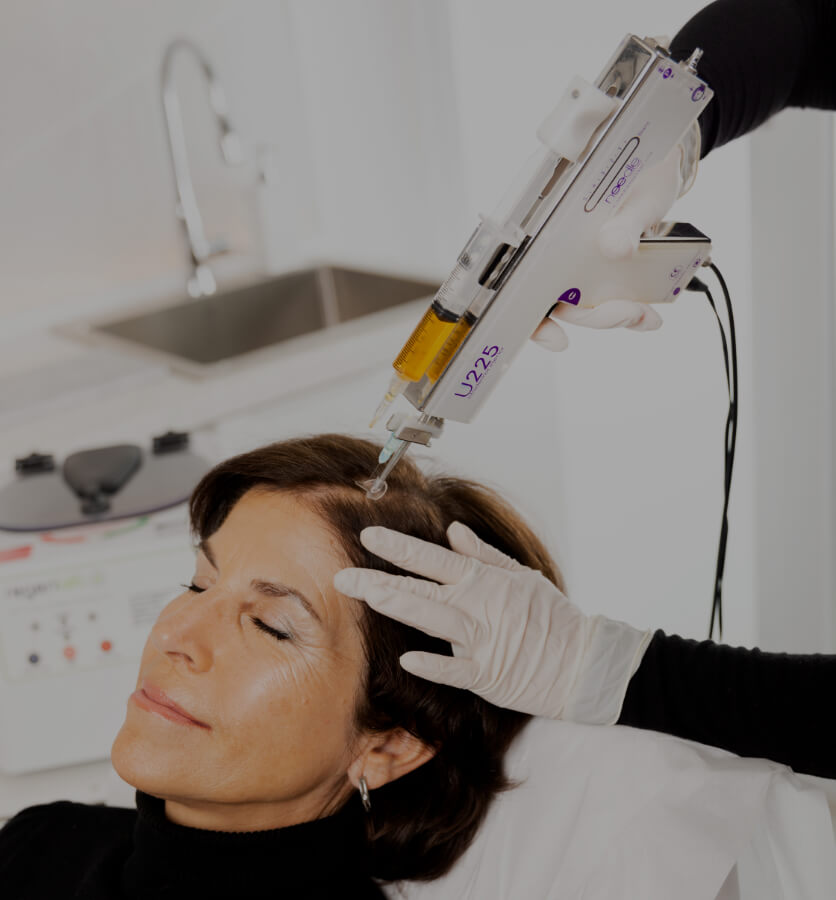 A nurse at Clinique Chloé performing a platelet-rich plasma treatment on a female patient's scalp