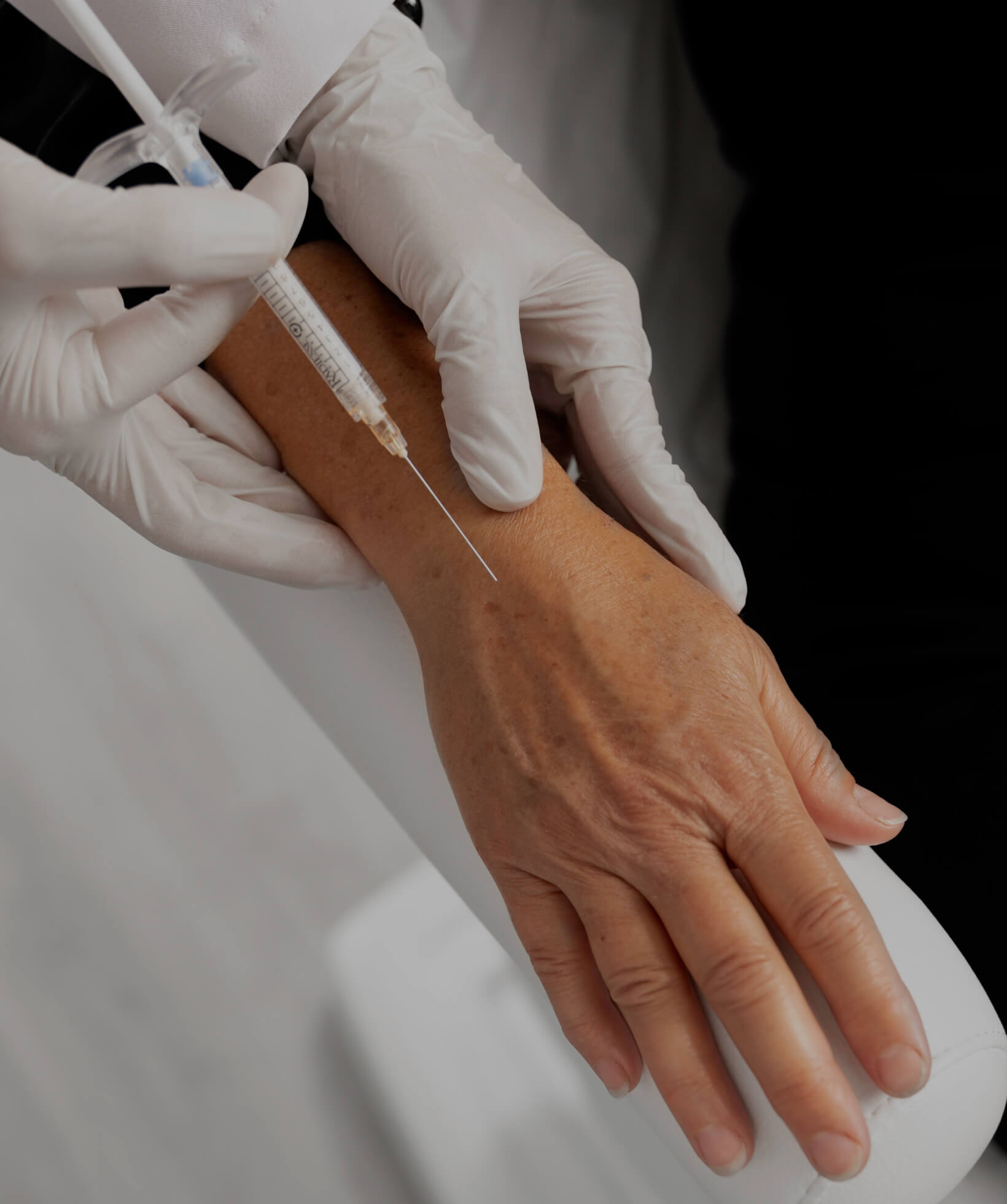 A doctor from Clinique Chloé doing Radiesse injections into the hands of a female patient
