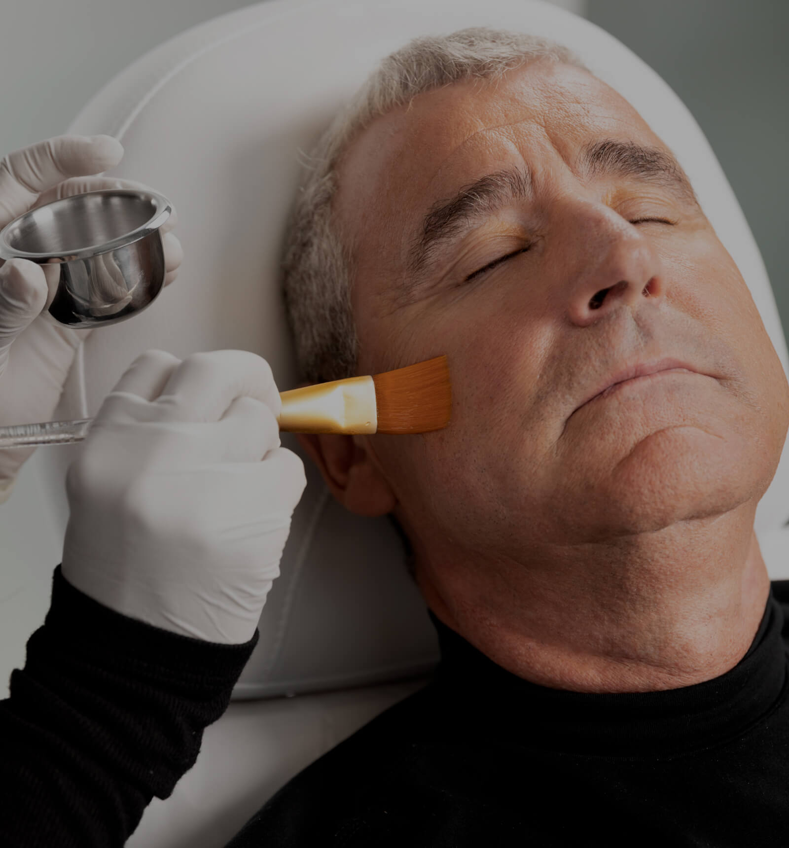 A technician from Clinique Chloé applying a chemical peel to a male patient's face with a brush