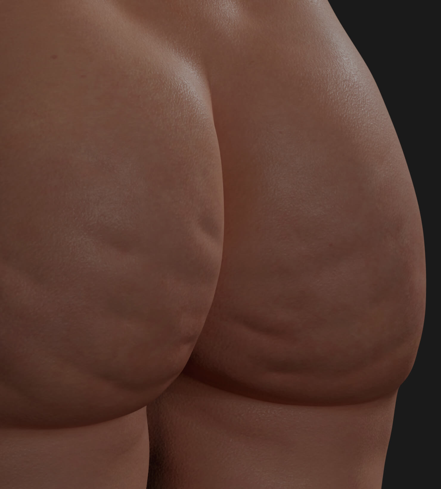 Buttocks of a Clinique Chloé female patient showing cellulite to be treated with Sculptra injections for cellulite reduction