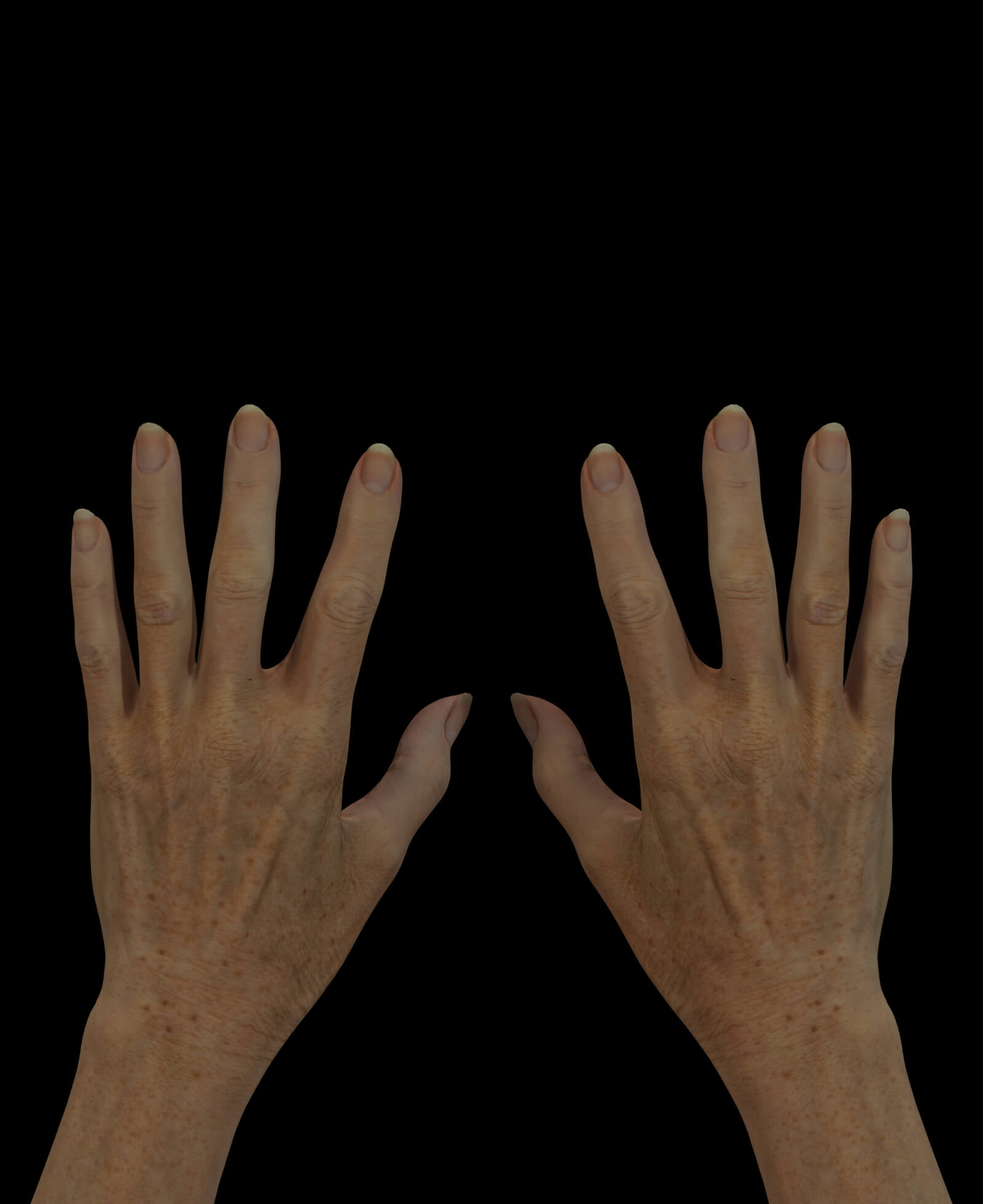 Patiente de la Clinique Chloé avec des mains vieillissantes