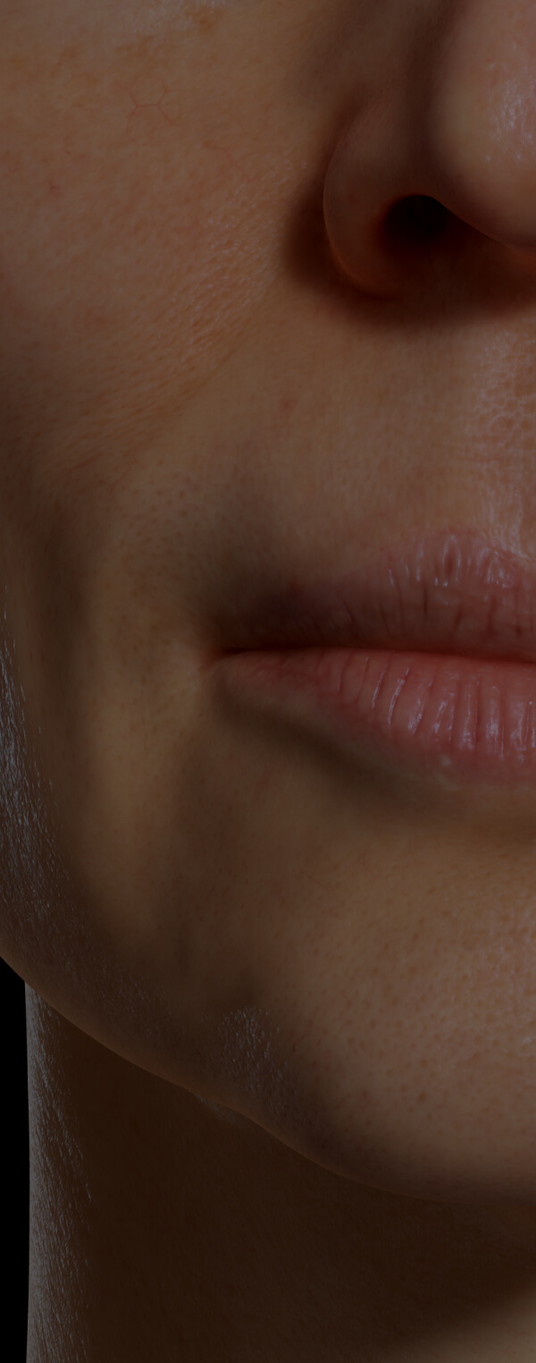 Patiente de la Clinique Chloé présentant une sécheresse des lèvres