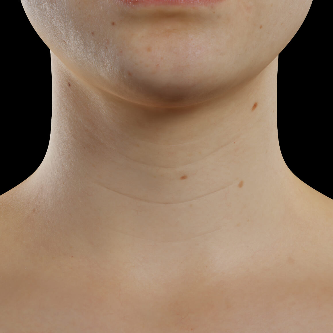A female patient from Clinique Chloé facing front showing wrinkles in the neck area
