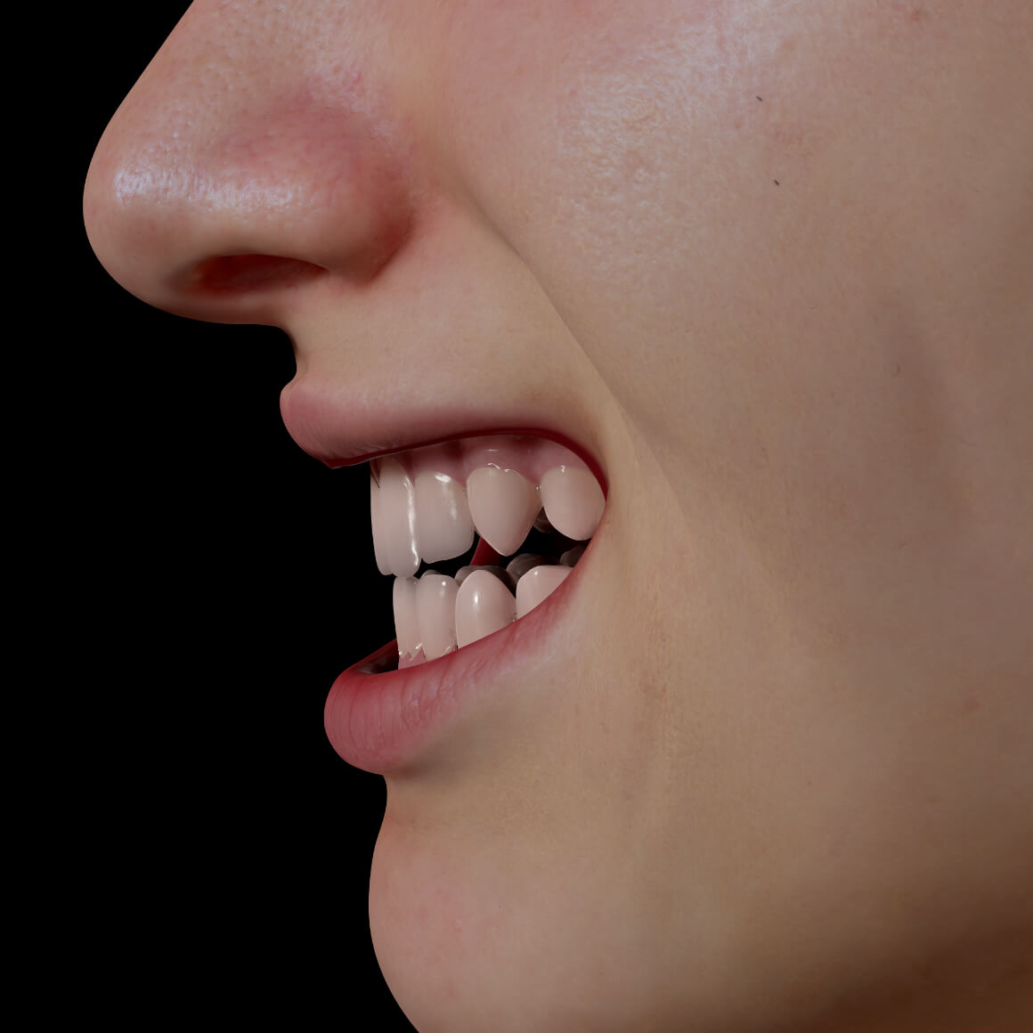 Sourire de côté d'une patiente de la Clinique Chloé avec des dents droites après un traitement d'alignement dentaire Invisalign 