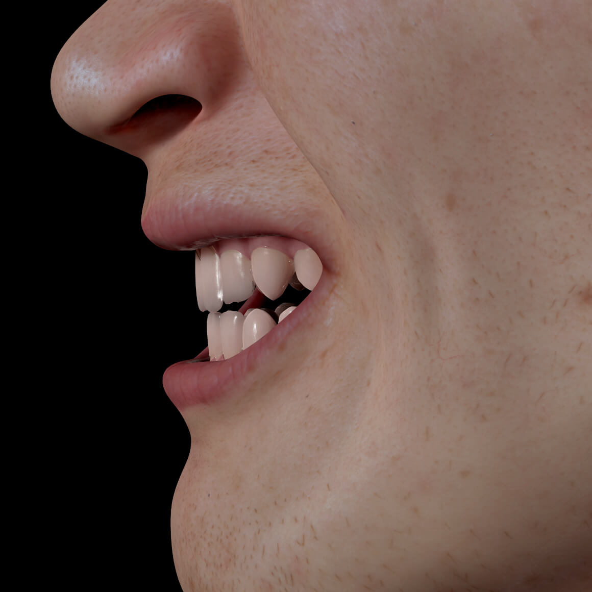 Sourire d'un patient de la Clinique Chloé positionné de côté démontrant des dents blanches après un blanchiment dentaire
